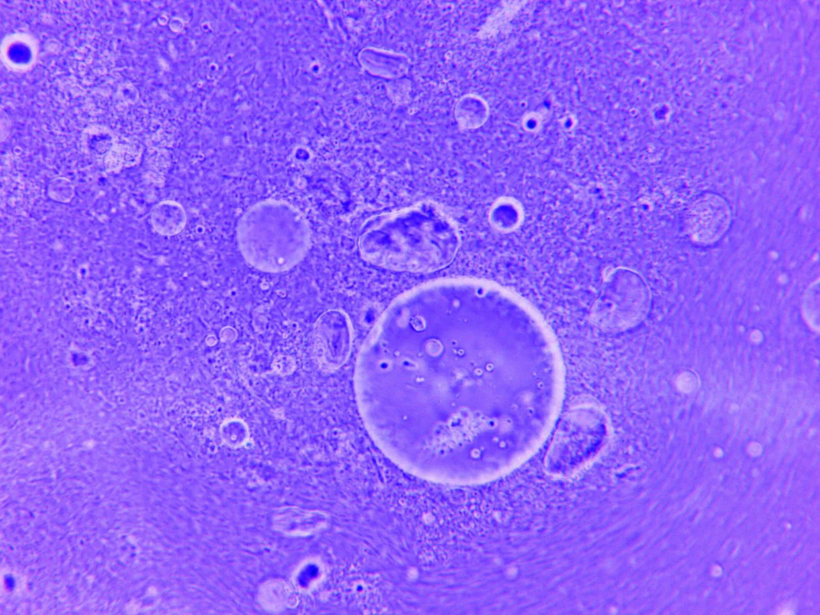 Fluorescent microscopy view of cells in blue and violet